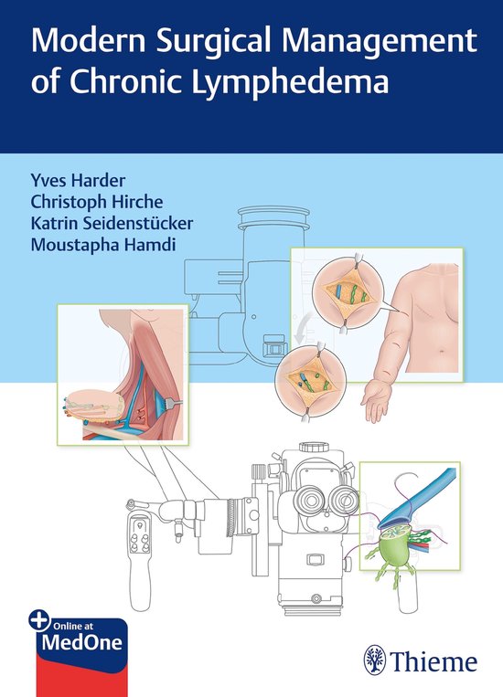 Modern Surgical Management of Chronic Lymphedema - cover