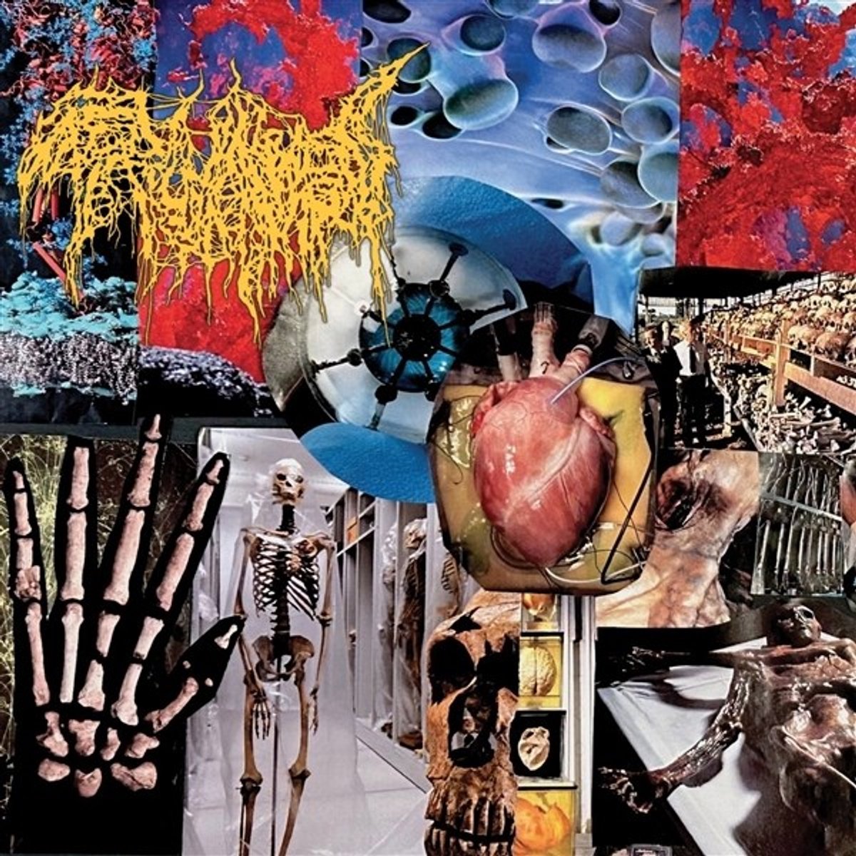 Trichomoniasis - Harvest Of The Killing Fields (CD)