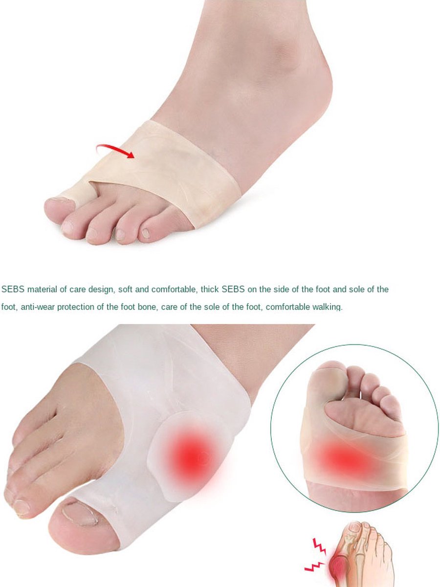 Hallux Valgus Siliconen Teenbeschermers I Teenspreiders I Teen Corrector I Knobbel I Bunion I Eeltknobbel | Teen Rechtzetten I 1 Paar I Wit