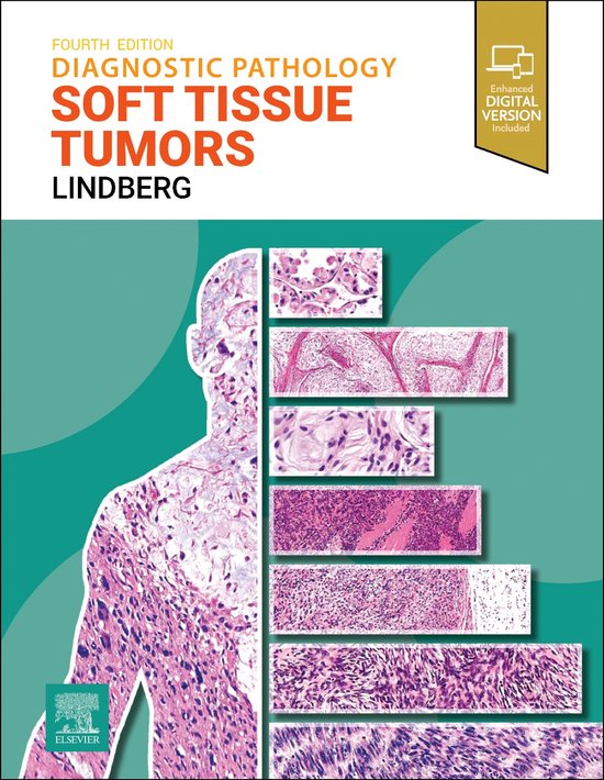 Diagnostic Pathology: Soft Tissue Tumors - cover