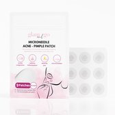 Glam and Go - microneedle pimple patches - micronaalden puistjes patches - microneedle acne patch