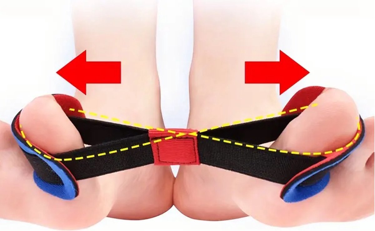 Goedkoopste Teen Spreider I Elastische Teen Stretcher I Hallux Valgus Teencorrector I Grote Teen Recht Maken I Blauw