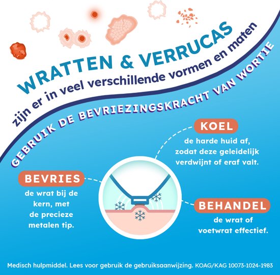 Wortie Cool wrattenverwijderaar 50 ml - eenvoudig Wratten en Voetwratten bevriezen voor kinderen en volwassenen, bevat 15 behandelingen, Medische hulpmiddelen voor Voet Wrattenbehandeling, met metalen punt, nieuwe verpakking Freeze zelfde formulering