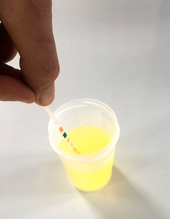 Urine Zelf Testen- 5 stuks - met duidelijk testblad - Urine teststrip voor o.a. Blaasontsteking - Brievenbus-levering - Zelftest Urineweginfectie - Levertest - Niertest - Ketose Strips - Bloed - Glucose - Urinetest - Curinda