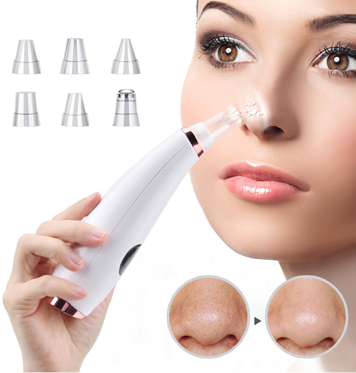 Mee-eterverwijderaar - Mee-eters verwijderen - Schoonheidsapparaat - Mee-eters verwijderen van gezicht en neus - Verwijdert acne en overtollig talg - 6 zuigkoppen - USB oplaadbaar - Gezichtsporiënreiniger - Unisex - 9×20×5,4 cm - Wit