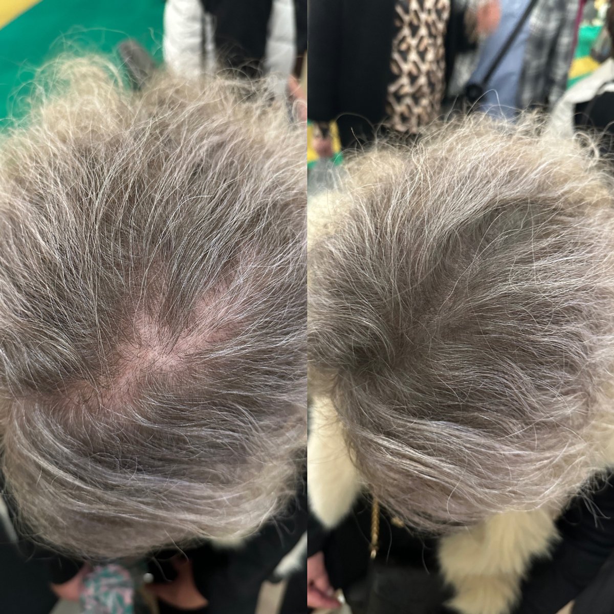BelleLux - Uitgroei Poeder Grijs – Haarmascara & Uitgroei Spray Alternatief – Grijze Uitgroei Verbergen – Waterproof – Dun Haar & Kale Plekken