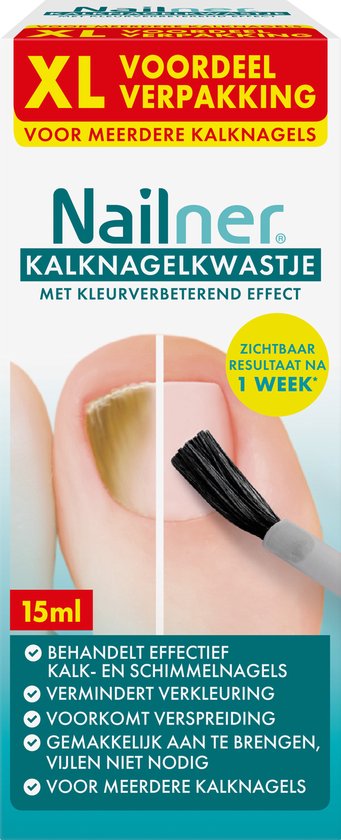 Nailner Kalknagelkwastje 15 ml met kleurverbeterend effect - Kalknagelbehandeling voor Kalk en Schimmelnagel, Medische hulpmiddelen om Kalknagels te behandelen en voorkomen, effect binnen 1 week, eenvoudig zonder te vijlen, voor dagelijks gebruik