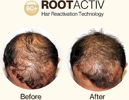 Sc Tutorial SC+ Rootactiv | bol