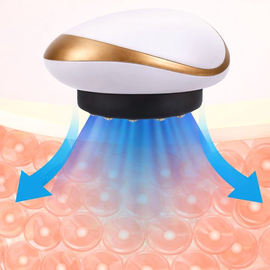 Velory - Cellulites Apparaat - Anti Cellulitis Apparaat - Cupping Apparaat - Gua Sha - Body Massager - Rugmassage Apparaten - Nekmassage Apparaat - Beenmassage Apparaat