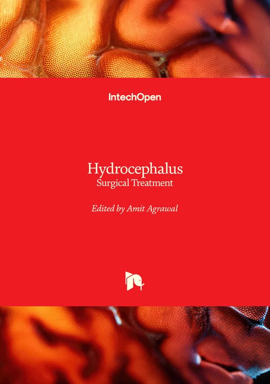 Hydrocephalus - cover