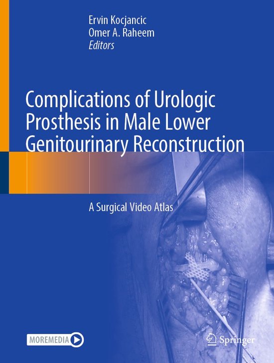 Medicine (R0) - Complications of Urologic Prosthesis in Male ... - cover