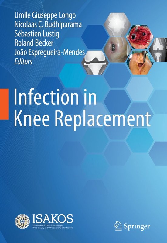 Medicine (R0) - Infection in Knee Replacement - cover