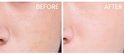 Gezicht voor en na gebruik van Nuxe Super Serum, met zichtbaar gladdere huid.