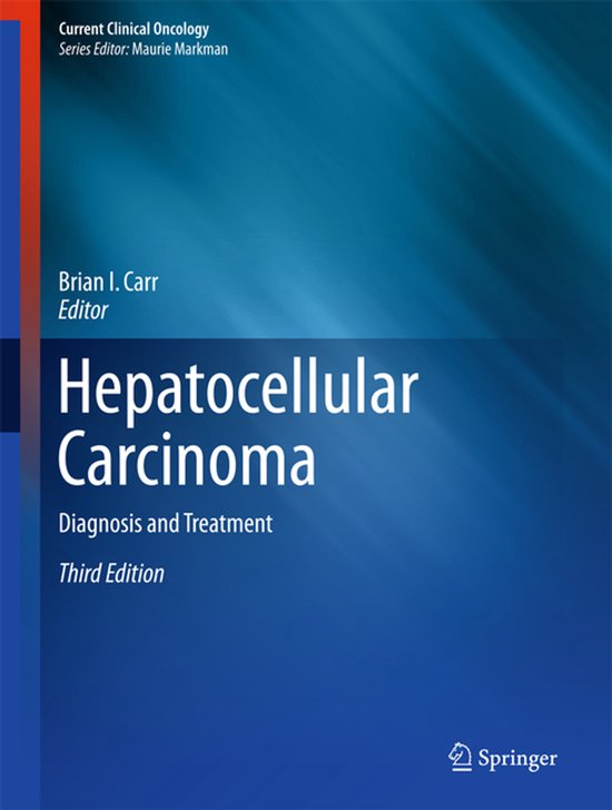 Hepatocellular Carcinoma - cover