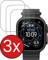 Apple Watch Ultra 3 | Transparant