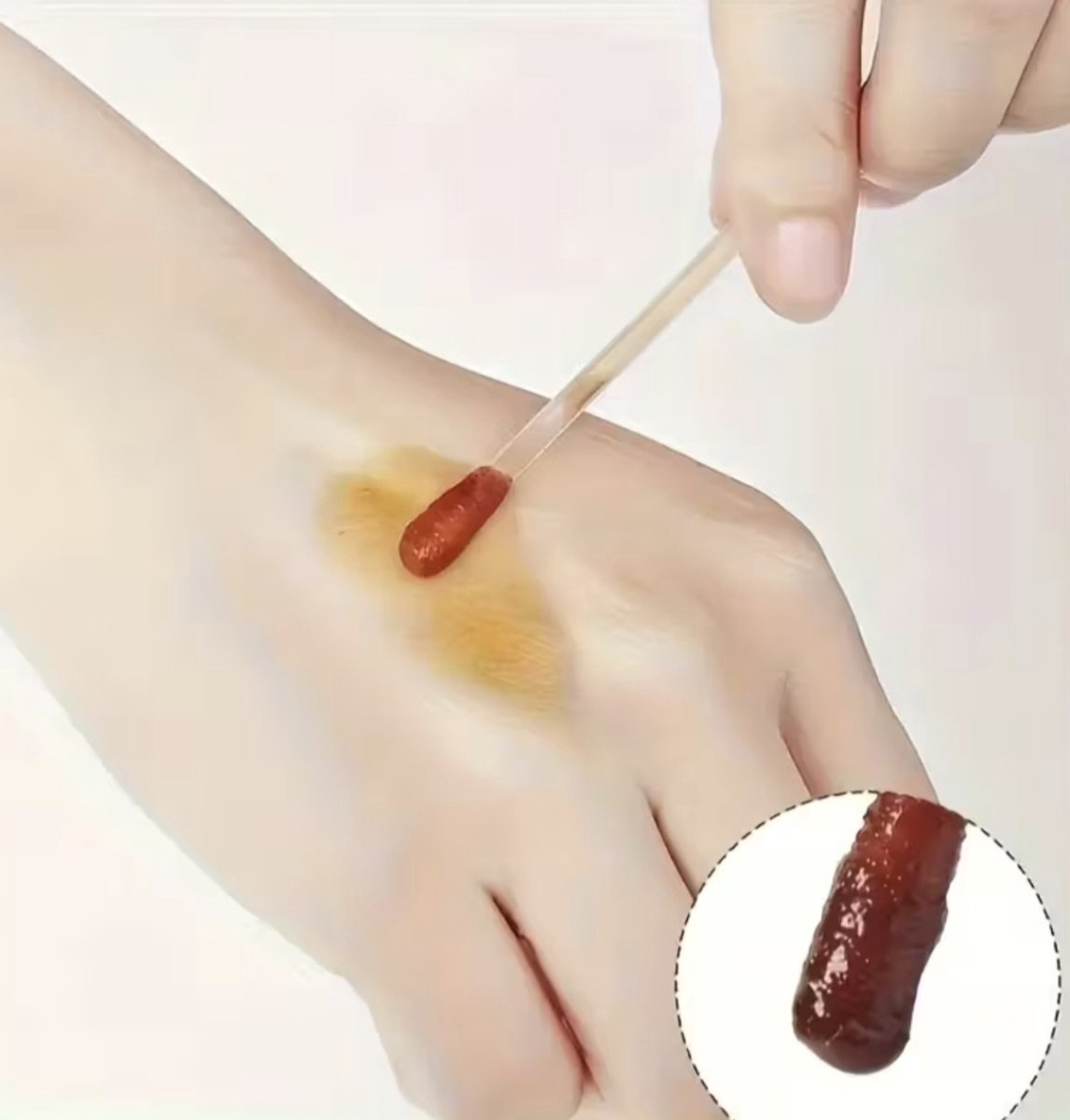 Wondverzorging Set – 5 Alcohol Wattenstaafjes & 5 Jodium Wattenstaafjes – Steriele Desinfectie Applicators voor EHBO en Ontsmetting