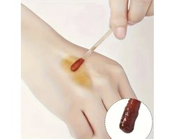 Wondverzorging Set – 5 Alcohol Wattenstaafjes & 5 Jodium Wattenstaafjes – Steriele Desinfectie Applicators voor EHBO en Ontsmetting