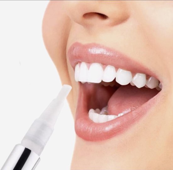 Teeth Whitening pen/Tandenbleken/Tandenbleek pen/Bleekpen/Witte tanden pen/Gel/Gel | bol.com