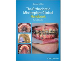 The Orthodontic Mini-implant Clinical Handbook