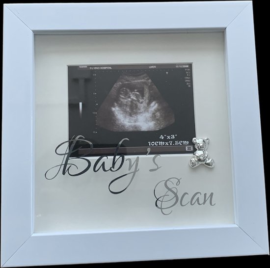 Fotolijst baby scan echo wit
