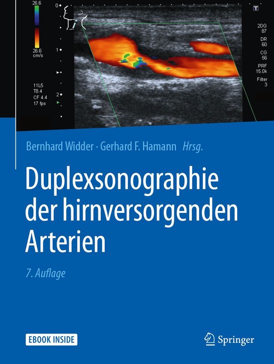 Medicine (German Language) - Duplexsonographie der hirnverso ... - cover