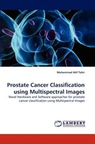 Prostate Cancer Classification using Multispectral Images