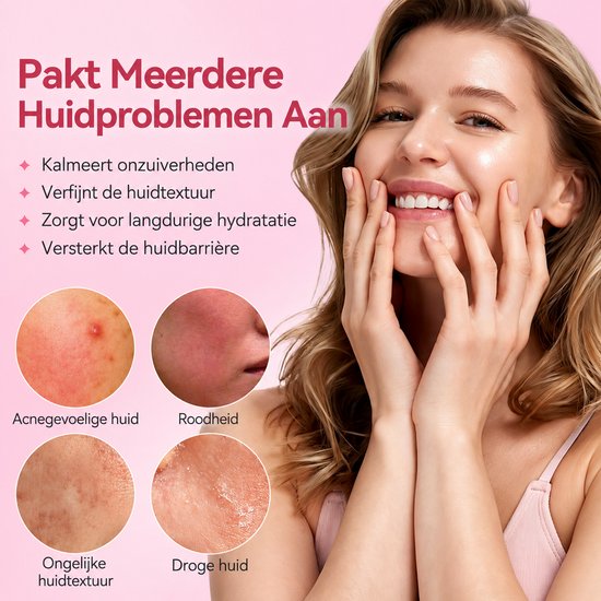 Een vrouw met een heldere huid glimlacht. In de cirkels worden huidproblemen zoals acne, roodheid, ongelijke textuur en droogte getoond.