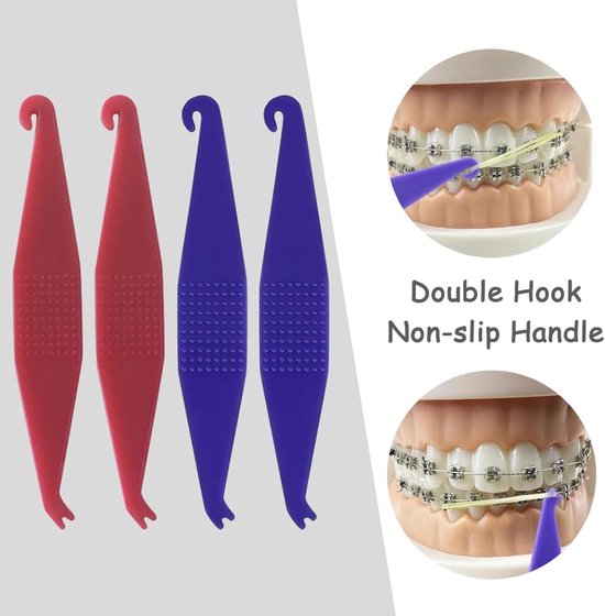 20 Stuks Orthodontische Elastische Haken voor Beugels - Elastische Koorden en Aanpassers in Diverse Kleuren — afbeelding 3