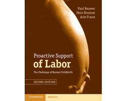 Proactive Support Of Labor