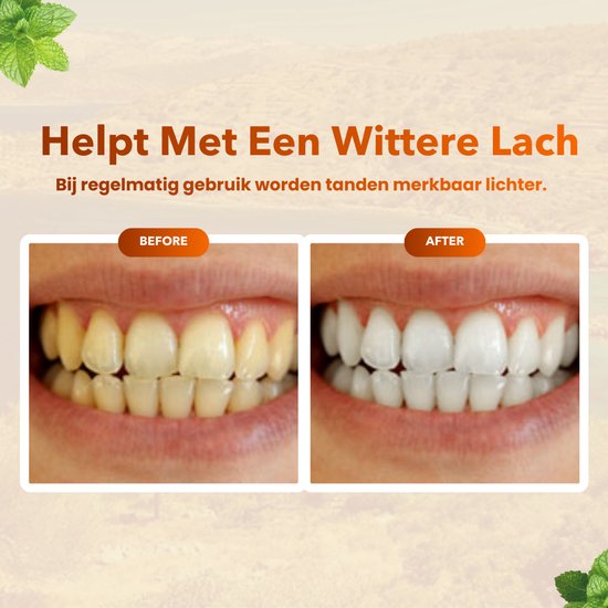 Voor en na foto's van tanden die witter zijn gemaakt door Apollo Remineralizing Gum.