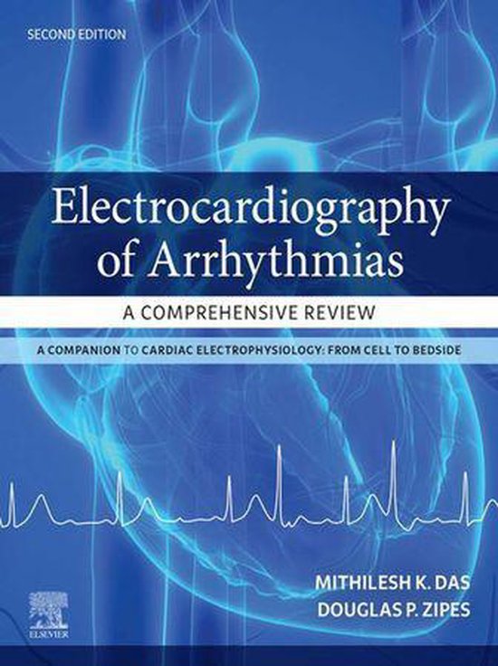 Electrocardiography of Arrhythmias: A Comprehensive Review E ... - cover