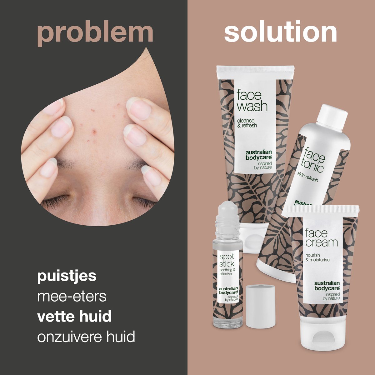 Australian Bodycare Anti - Puistjes pakket met Tea Tree Olie thumbnail 5