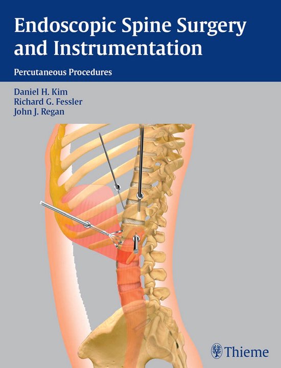 Endoscopic Spine Surgery and Instrumentation - cover