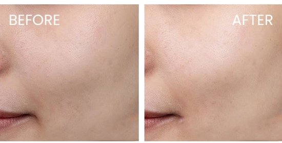 Caudalie Beauty Elixir Spray - Stralende Huid - 30ml