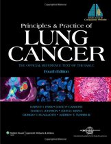 Principles and Practice of Lung Cancer