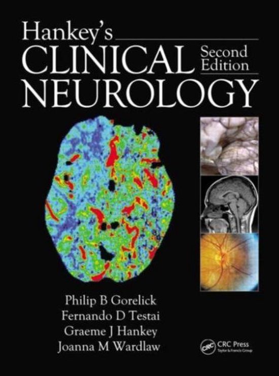 Hankey's Clinical Neurology - cover