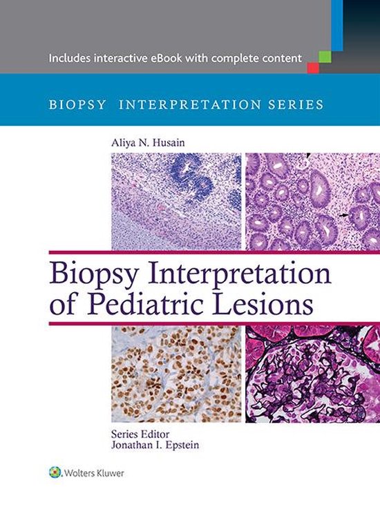 Biopsy Interpretation Series Biopsy Interpretation of Pediatric Lesions (ebook),... bol