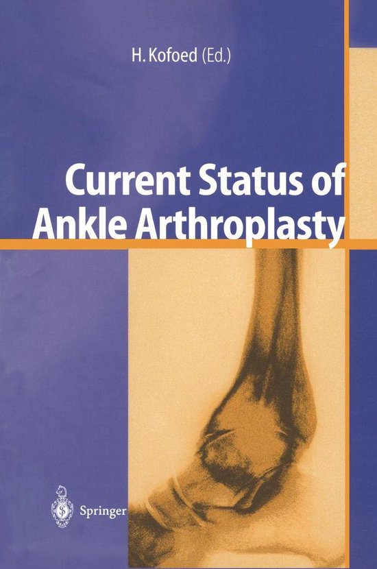Current Status of Ankle Arthroplasty - cover
