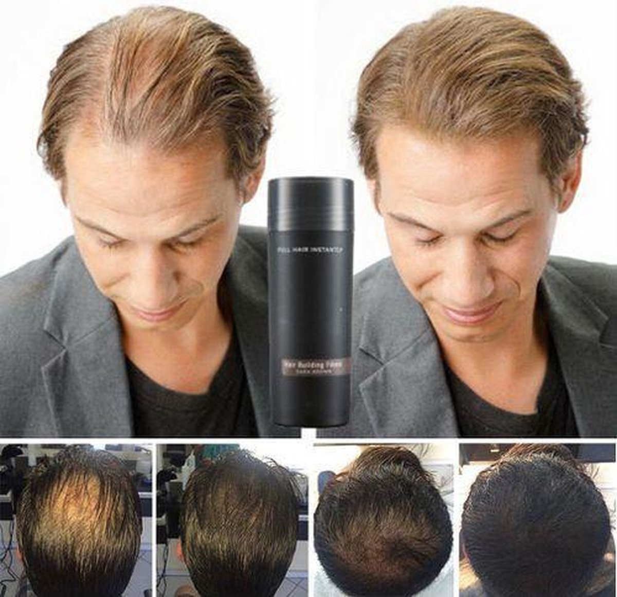 TOPPIK haarvezels 27,5 gr Donkerbruin + TOPPIK Hairline Optimizer