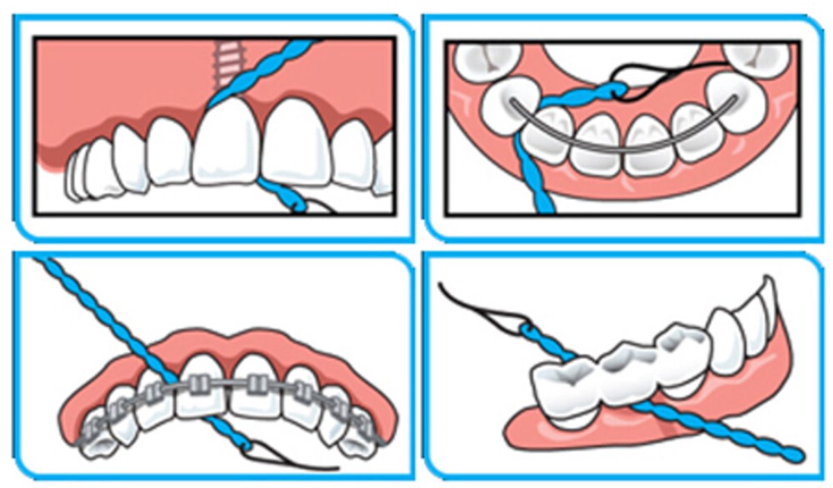 Goedkoopste 3x iDontix X-Floss Lite 30 stuks