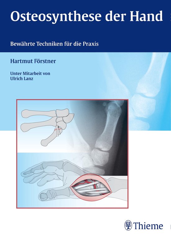 Osteosynthese der Hand - cover
