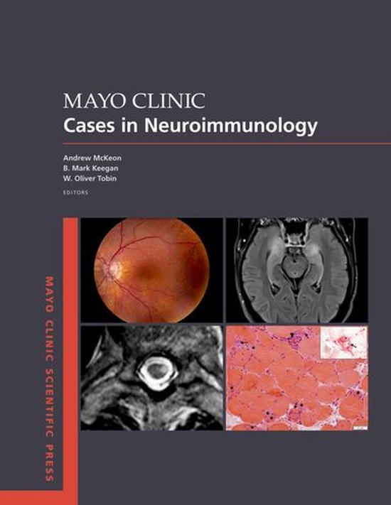 Mayo Clinic Scientific Press - Mayo Clinic Cases in Neuroimm ... - cover