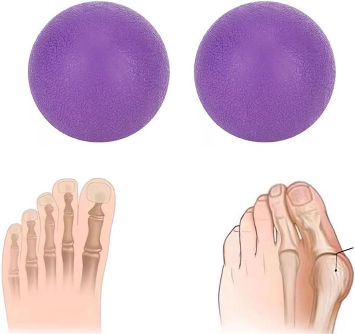 Voetmassagebal - Therapiebal - Spierontspanning - Gerichte Weefselmassage - 7 cm - Paars