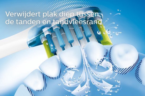 Illustratie van een Philips Sonicare C3 opzetborstel die tussen tanden en tandvlees reinigt.