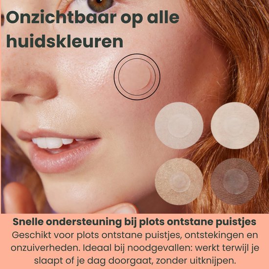 Close-up van een gezicht met 4 puistjespatches in verschillende huidtinten.