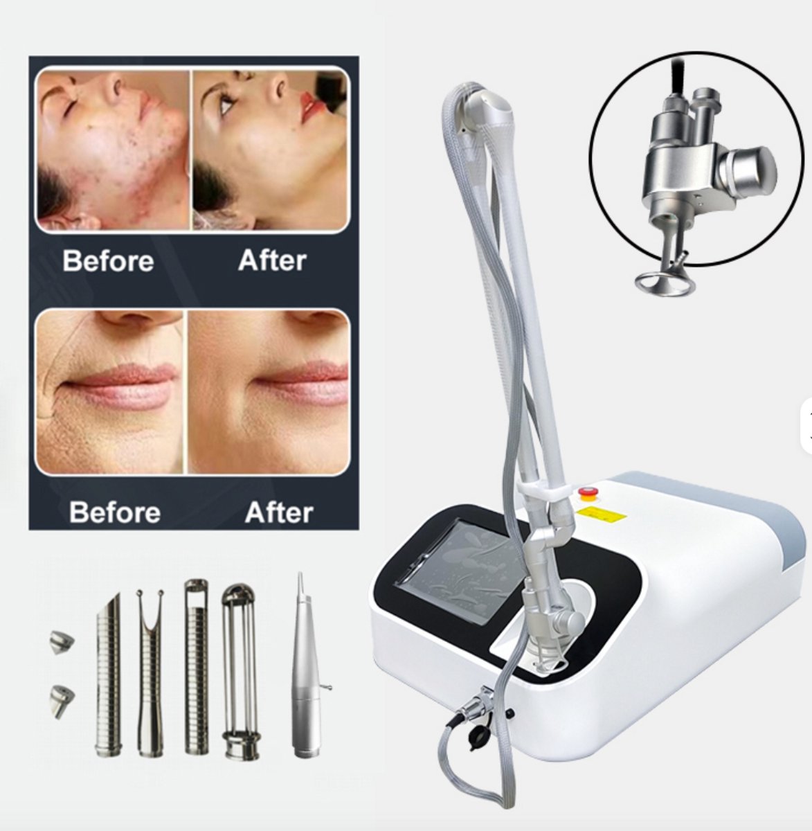 CO2 Fractionele Laser - Professional use