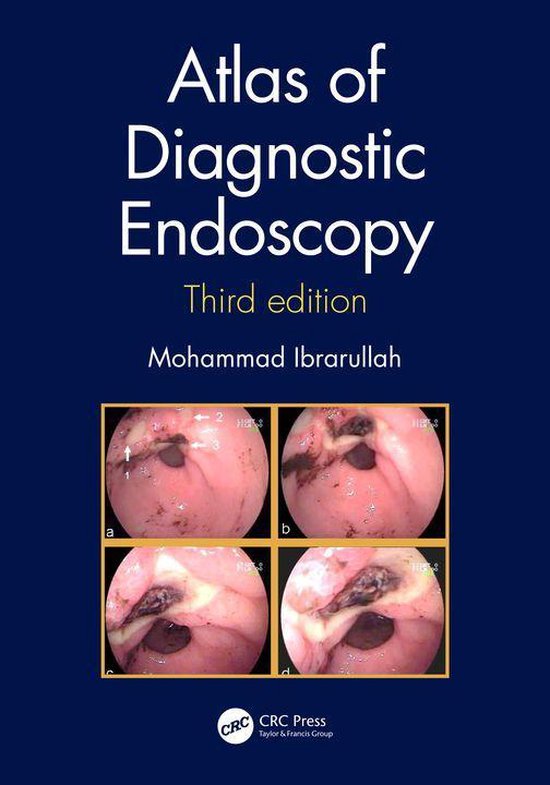 Atlas of Diagnostic Endoscopy, 3E - cover