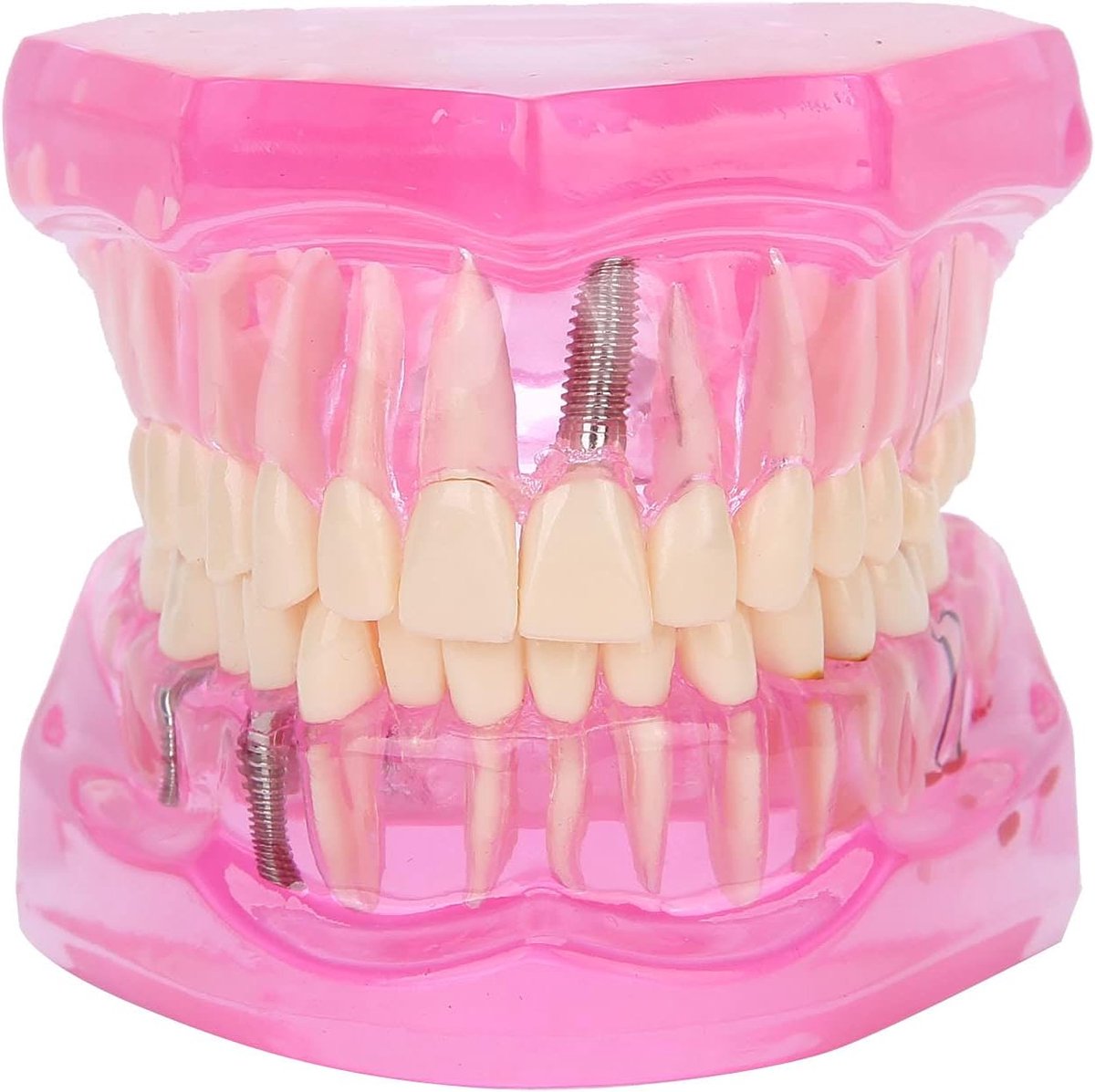 Teeth Model, Transparent Adult Dental Models, Repair Studying Dental Teeth Mode Tools, Fake Teeth Compatible For - ShopVlot
