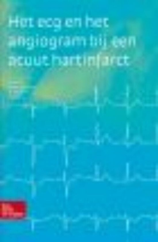 Dutch language eBook collection - Het ecg en het angiogram b ... - cover