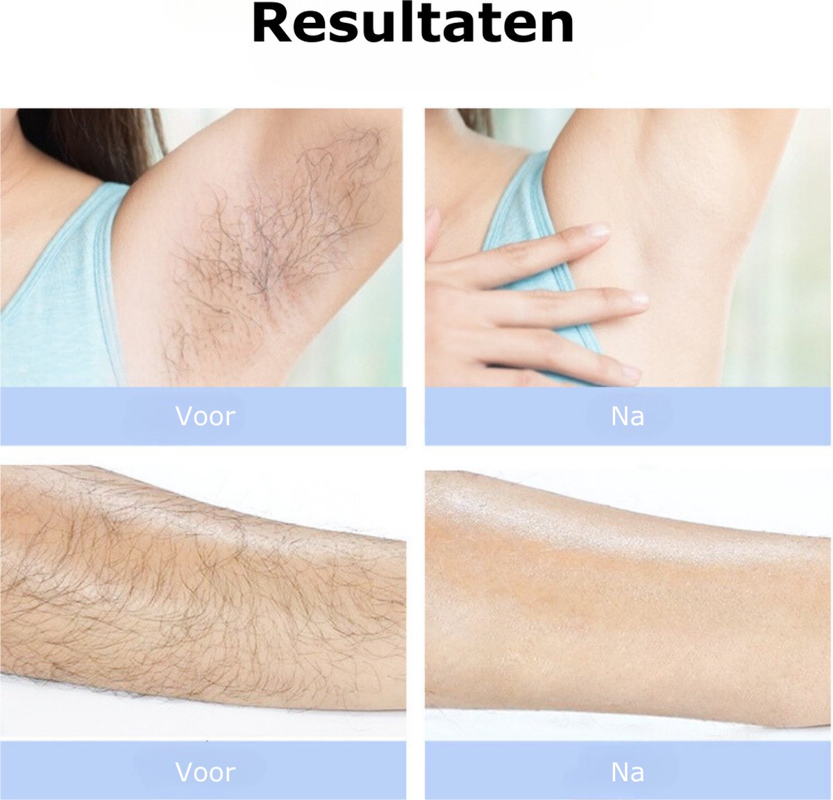 Epileerapparaat Dames Voor Gezicht - Laser Ontharingsapparaat 1000000 Flitsen - IPL Ontharingsapparaat 8 Standen Veiligheidsbril Scheermesje - Wit thumbnail 6